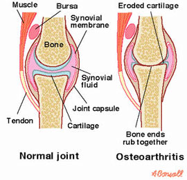 Synapsis of osteoarthritis muscle atrophy and