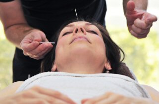 Acupuncture in forehead