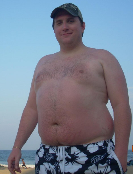 Fat on the beach