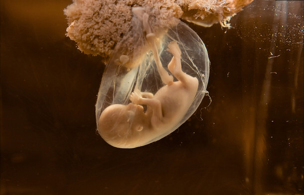 Human embryo