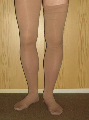 Compression Stockings