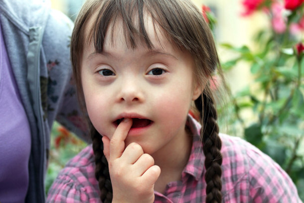 Young Girl With Down Syndrome