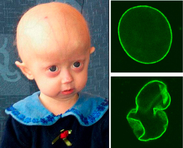 Physical Defects to the Left - Cell Nucleus Mutations to the Right