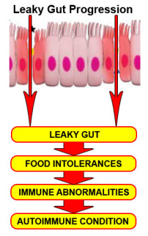 Leaky gut