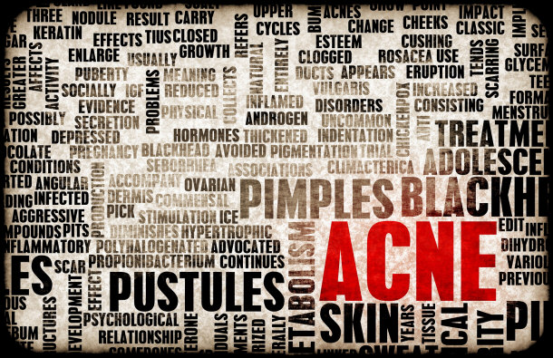 skin problems acne concept 