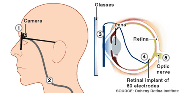 eye camera