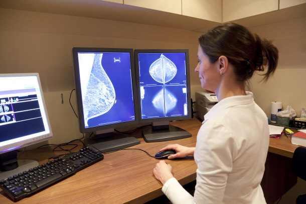 Mammography Test