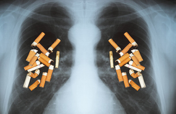 smoking disease illness concept