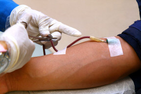 Blood transfusion