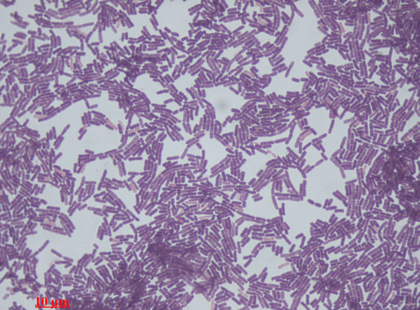 Gram Stain of Bacillus Species