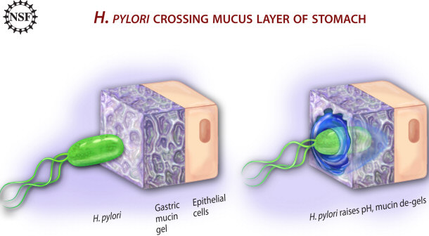 H Pylori crossing stomach layers