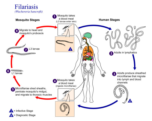 filariasis stages