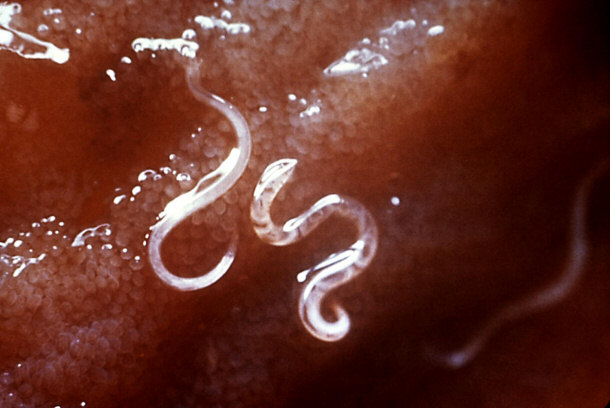 Ancylostoma caninum - Type of Hookworm Attached to Intestinal Mucosa