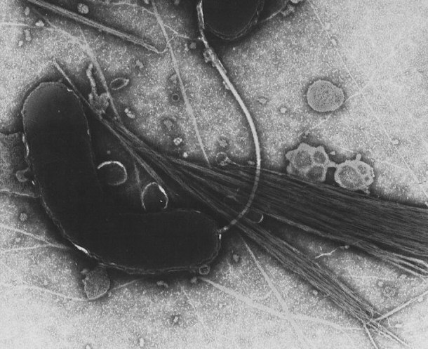 Transmission Electron Microscope Image of Vibrio Cholerae - The Bacteria Responsible for Cholera