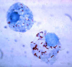 Rickettsia Bacterium Under Microscope