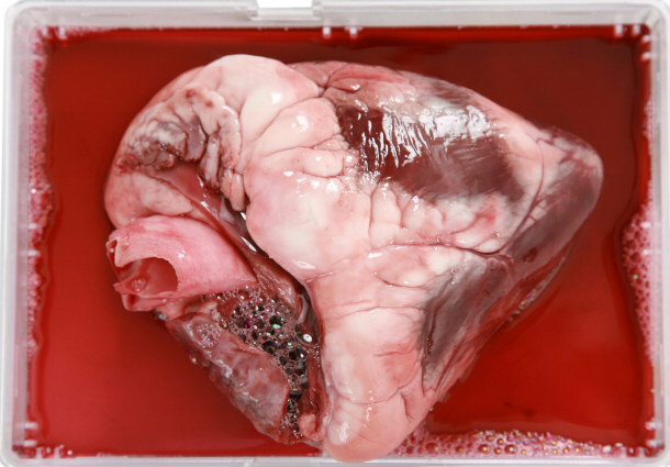 Human Heart Ready for Transplant