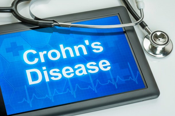Crohn's Disease is enough for some to commit suicide.